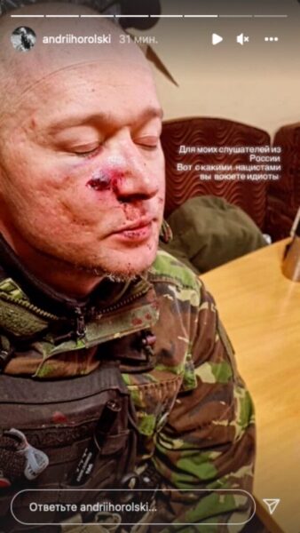 Лидер «Бумбокса» Андрей Хлывнюк получил осколочное ранение Лидер «Бумбокса» Андрей Хлывнюк получил осколочное ранение