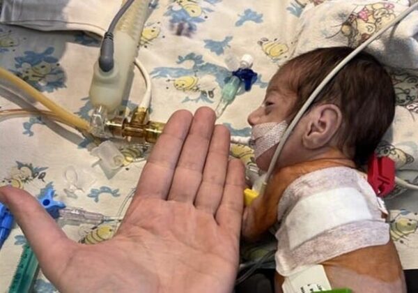 В Одессе прооперировали двух грудных детей с врожденными пороками сердца В Одессе прооперировали двух грудных детей с врожденными пороками сердца